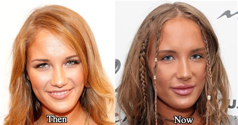 Niykee Heaton: Before And After Transformation